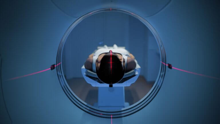 risonanza magnetica e IA