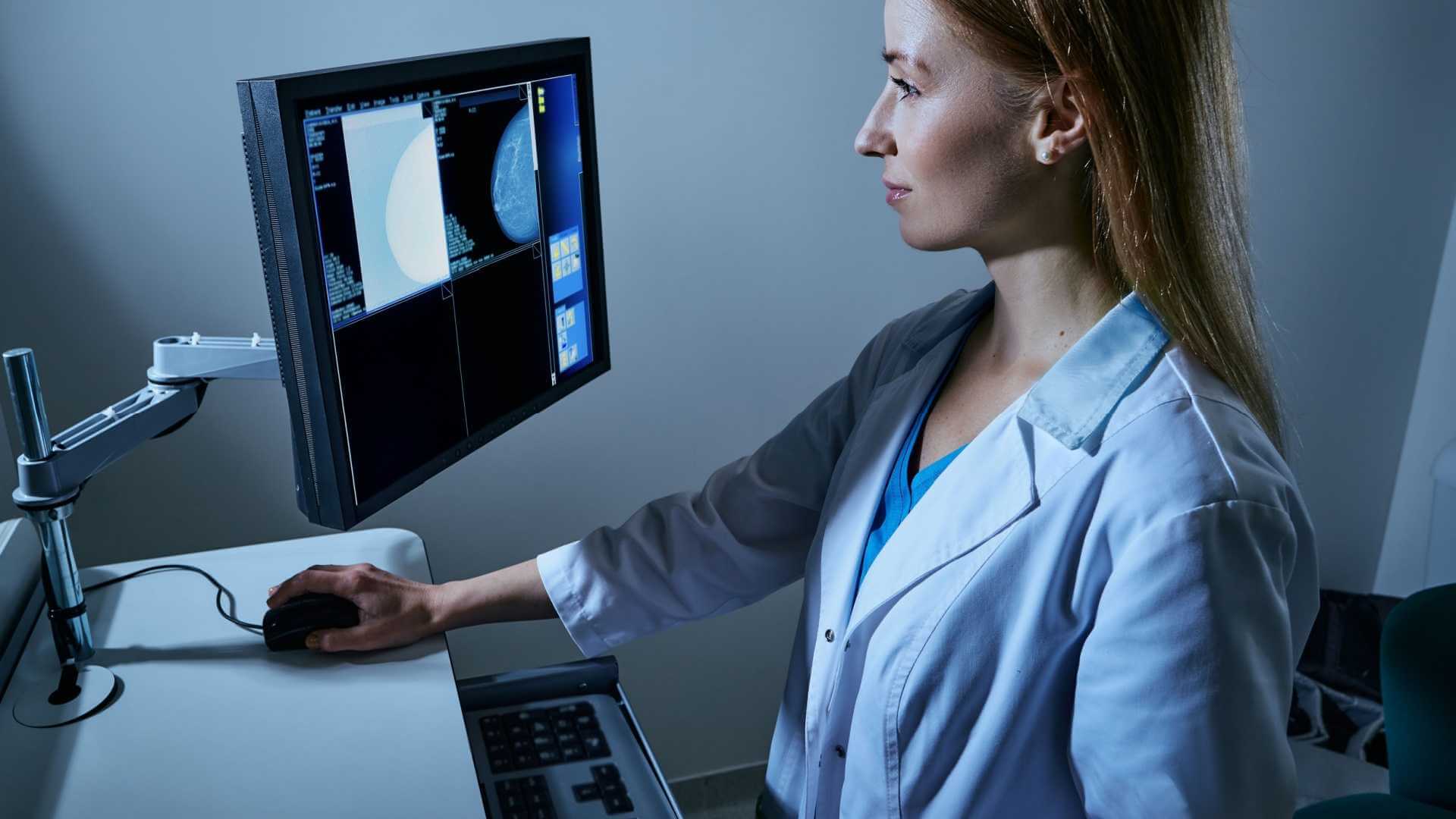 Tumore al seno: come l’IA legge il rischio nelle mammografie