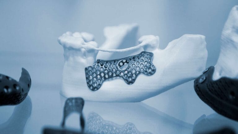 stampa 3D in ospedale