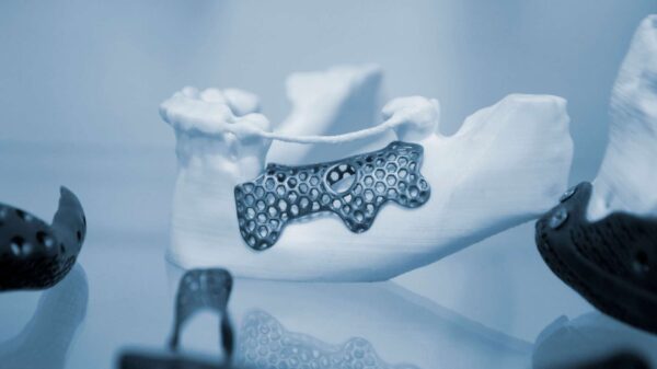 stampa 3D in ospedale